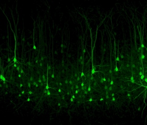 Alcuni neuroni della corteccia visiva, marcati con una proteina fluorescente