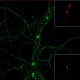 Immagine di cellule del cervello