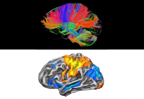  Esempio di neuroimmagini anatomiche e funzionali del cervello.